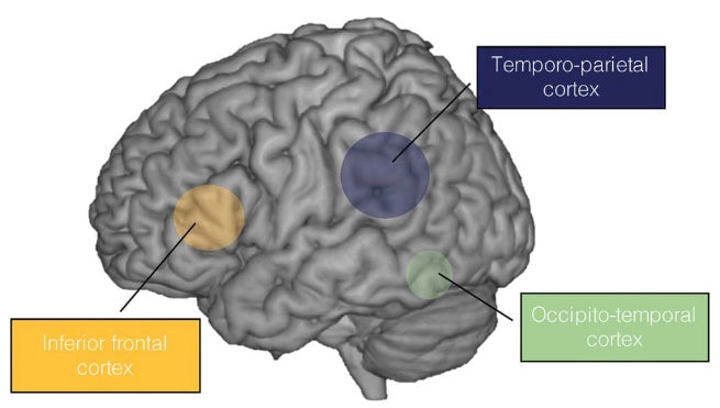 A brain model with three reading regions marked: inferior frontal, temporo-parietal, and occipito-temporal cortex