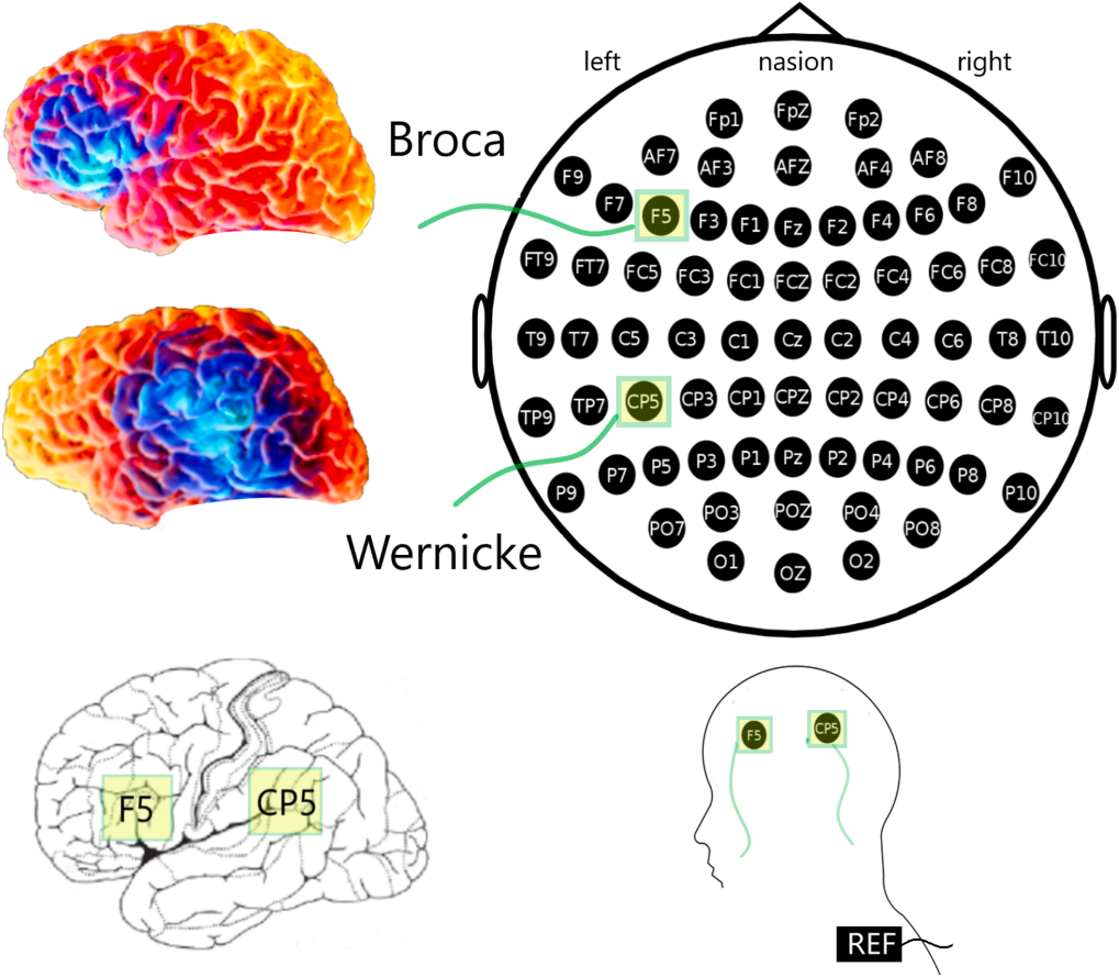 Brain rendering showing Broca's and Wernicke's areas alongside an EEG cap montage used for stimulation